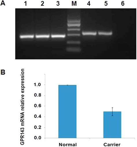 Reverse Transcription Pcr And Real Time Quantitative Pcr Analysis Of