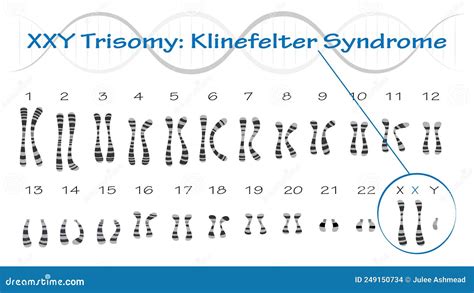 Klinefelter Syndrome Drawing