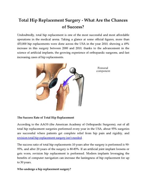 Total hip replacement surgery what are the chances of success by Jennifer Martin - Issuu