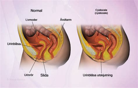 Health Condition Symptoms Causes Treatment And More