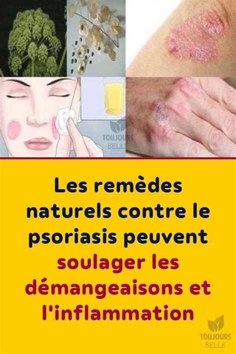 Les Rem Des Naturels Contre Le Psoriasis Peuvent Soulager Les