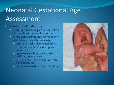 Ppt Neonatal Gestational Age Assessment Powerpoint Presentation Free