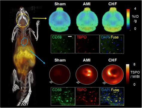 Simultaneous Tracer Uptake Of Mitochondrial Translocator Protein Tsp