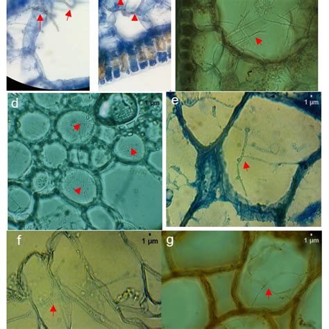 Pdf Colonization And Antagonistic Activity Of Endophytic Fungi In