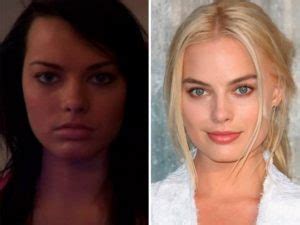 Margot Robbie Before and After Plastic Surgery