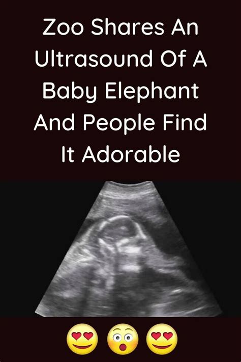 Zoo Shares An Ultrasound Of A Baby Elephant And People Find It Adorable in 2022 | Baby elephant ...