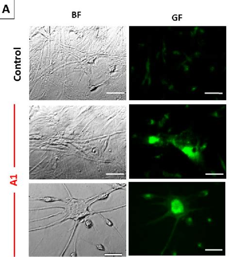 Figure 2 From Store Operated Calcium Entry Inhibition And Plasma