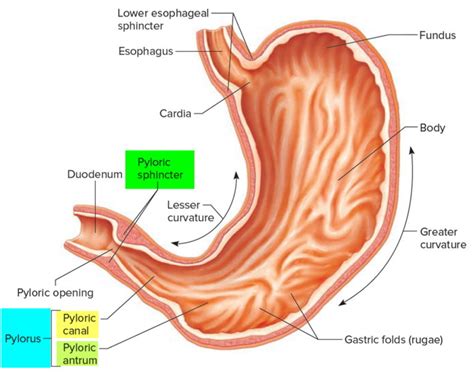 Pyloric Stenosis - Causes, Symptoms, Complications, Treatment