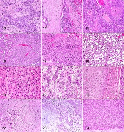 Carcinoma And Malignant Myoepithelioma Mammary Gland Canine Both The