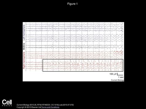 Epilepsy Current Biology Ppt Download