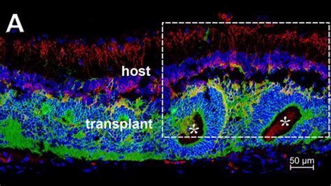 Rod Bipolar Cells Image Eurekalert Science News Releases