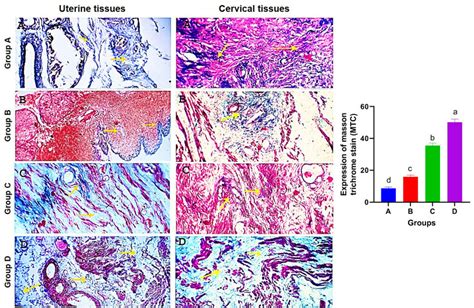 Photomicrographs Of Uterine And Cervical Specimens Stained With Masson