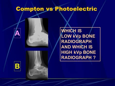 Radiation Interactions Ppt Video Online Download