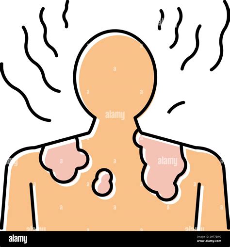 Sunburn Skin Disease Color Icon Vector Illustration Stock Vector Image