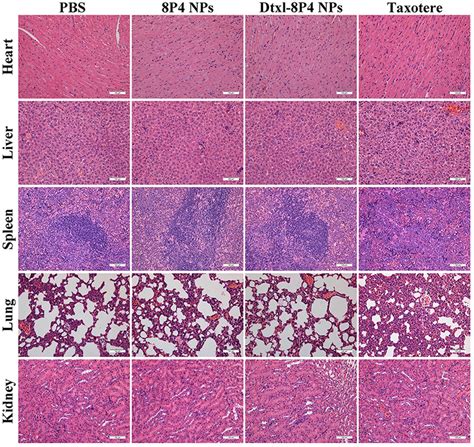 Frontiers Significant Suppression Of Non Small Cell Lung Cancer By