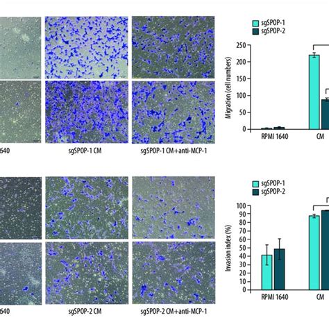 The Migration And Invasion Of Sgspop And Sgspop Cells In Response