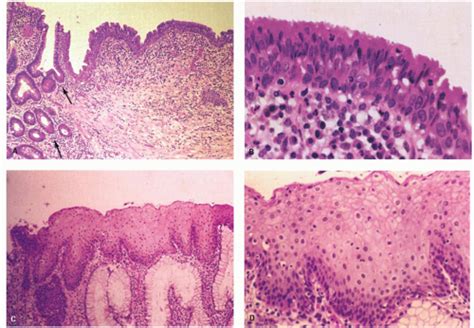 Pectinate Line Histology