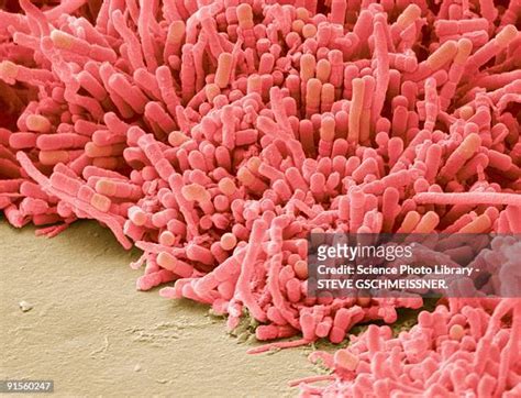 3,347 Plaque Bacteria Stock Photos, High-Res Pictures, and Images ...