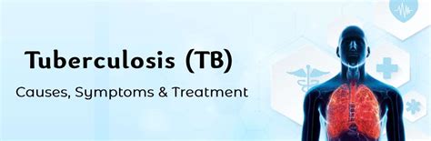 Tuberculosis Tb A Survival Guide To End Tb Ganesh Diagnostic