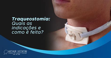 Curativo Para Traqueostomia Em 2021 Curativo Traqueos