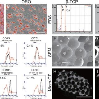 Matrix Deposition And Osteogenic Differentiation Of Hbmmscs Seeded On