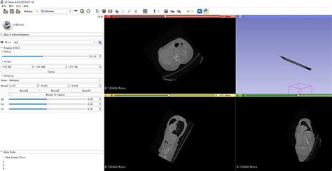 Uploading Dicom Files Support 3d Slicer Community