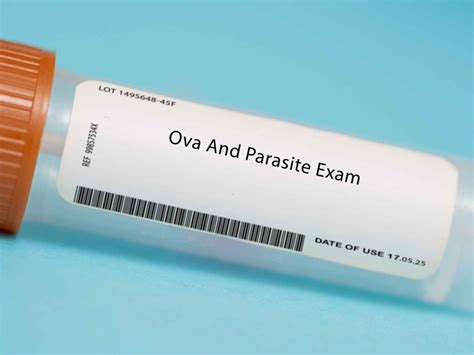 Parasite Ova And Parasite Test Labs Ibs Gut Health Clinic