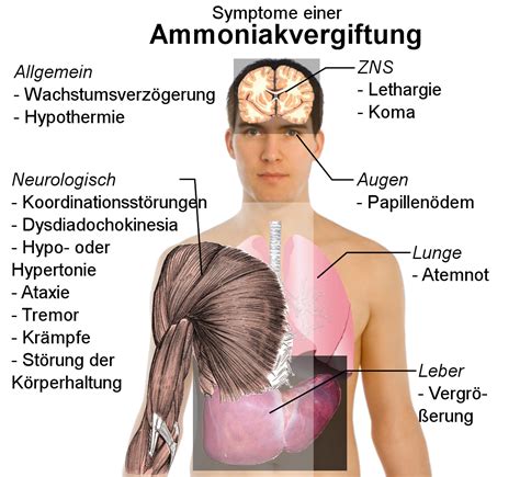 Ammoniak