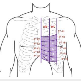 Ten-point interrogation grid. LSB: left sternal border; MC ...