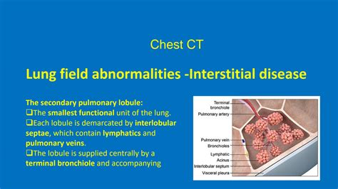 Secondary Pulmonary Lobule