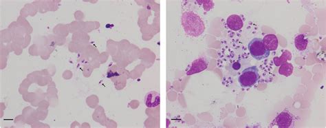 Frontiers Metagenomic Analysis Identifying A Rare Leishmania