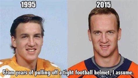 Simon Woods On Twitter Peyton Manning Has The Vertically Expanded Forehead Caused By Growth