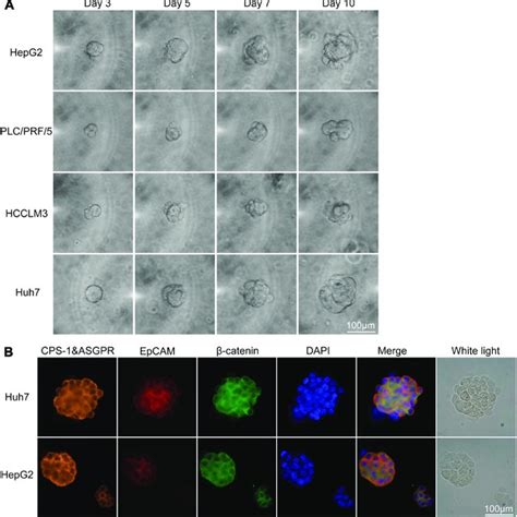 Culture And Identification Of Ctc Spheroids From The Hcc Cell Lines Download Scientific