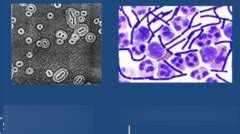 Bacterial Smears And Simple Staining Diagram Quizlet