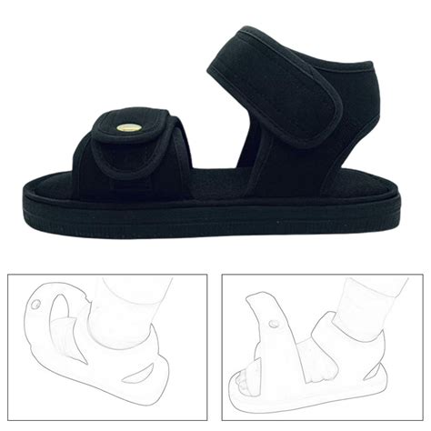 Por Que Duele Cuando Te Pones Un Zapato Ortopedico 3
