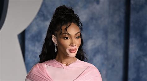 Winnie Harlow Rocks High Leg Bikini Poses With Adorable Puppy In