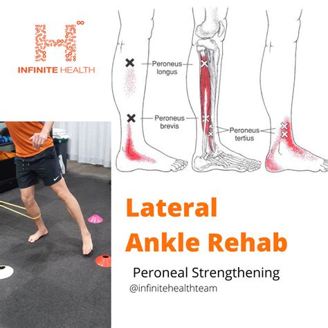 Lateral Ankle Rehab Peroneal Strengthening