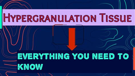 Hypergranulation Tissue Causes And Management Treatment Management Of Hypergranulation Tissue