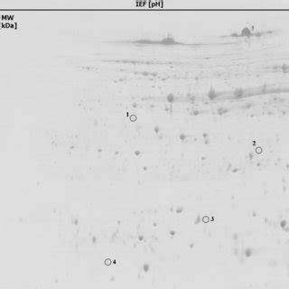 2 DE Protein Map Of Mature Rye Grain From 20 Recombinant Inbred Lines