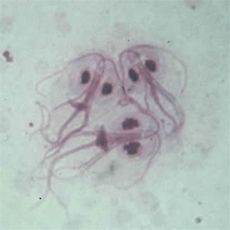 Giardiasis Causes Symptoms Prevention Diagnosis Treatment