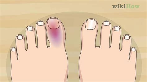 How To Know If Your Toe Is Broken Advice From A Foot Surgeon