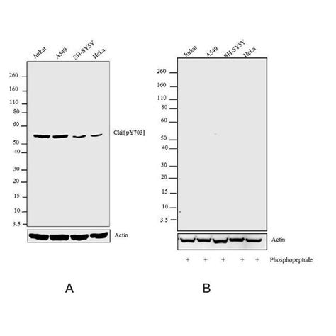 Phospho C Kit Tyr703 Recombinant Polyclonal Antibody 22hclc