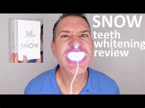 Snow Teeth Whitening Review Unboxing Does Snow Really Work