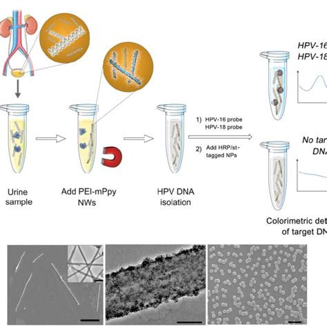 HPV DNA test results according to cytological diagnosis | Download Scientific Diagram