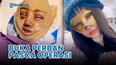 Wajah Baru Lucinta Luna Setelah Operasi Potong Leher Youtube