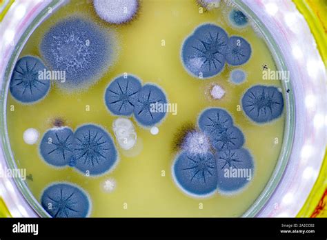 Colony Of Skin Fungi In A Petri Dish Stock Photo Alamy