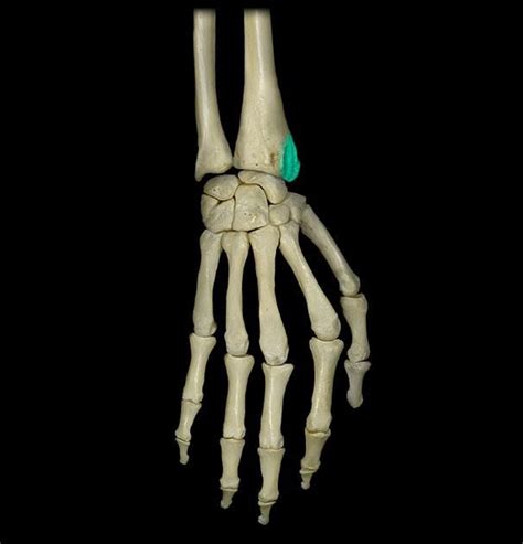 styloid process of radius | Styloid Process- Ulna | Body, Upper body ...