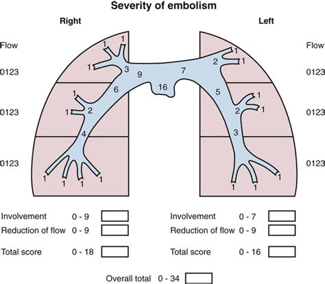 Percutaneous Interventions For Acute Pulmonary Embolism Radiology Key