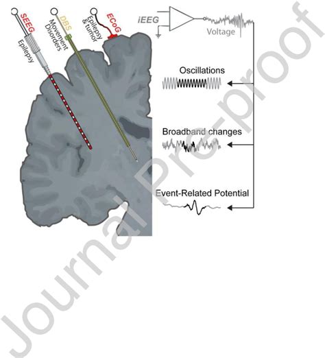 Figure 1 From Advances In Human Intracranial Electroencephalography Research Guidelines And