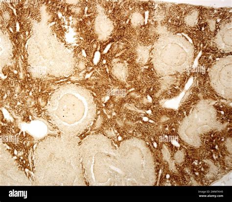 Spleen Macrophages Light Micrograph Stock Photo Alamy